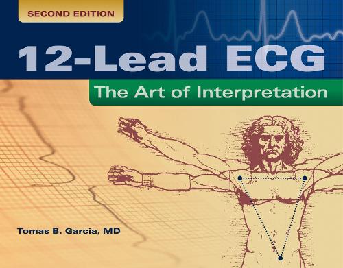 12-Lead ECG: The Art of Interpretation: The Art of Interpretation