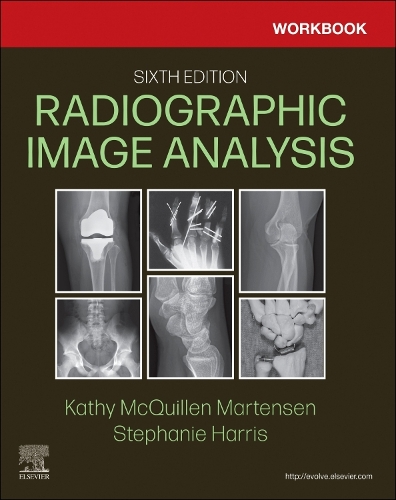 Workbook for Radiographic Image Analysis - E-Book: Workbook for Radiographic Image Analysis - E-Book (ePub eBook)